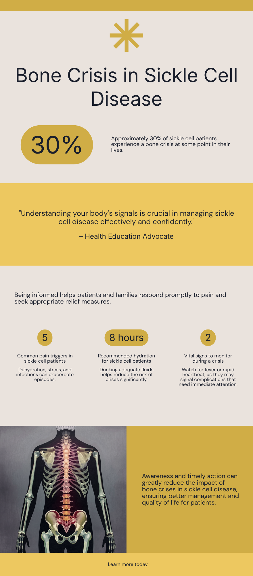 Bone crisis in sickle cell disease infographic — what it is, symptoms, where it hurts, triggers, and relief